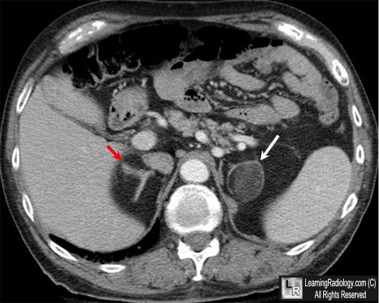 LearningRadiology