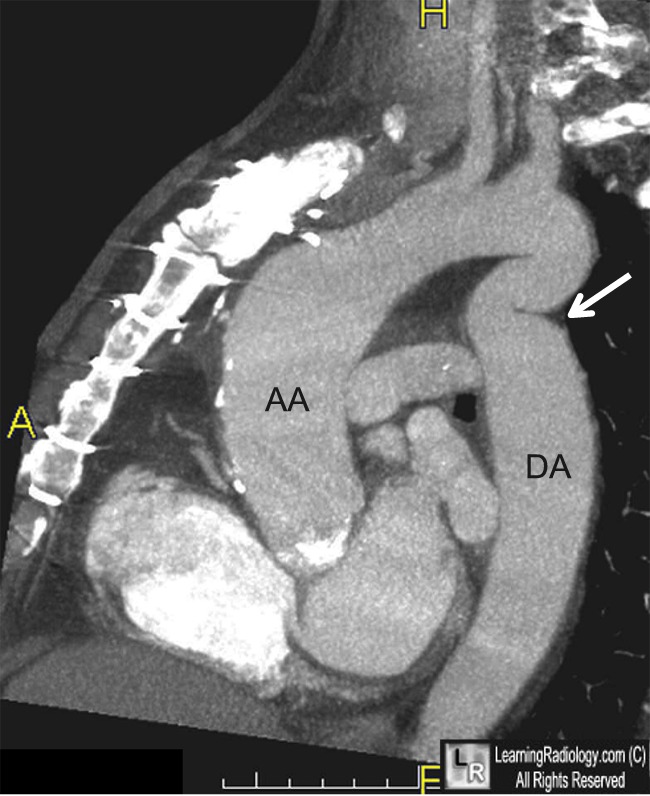 Learningradiology