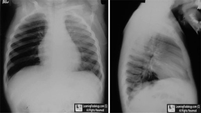 Welcome To Learningradiology