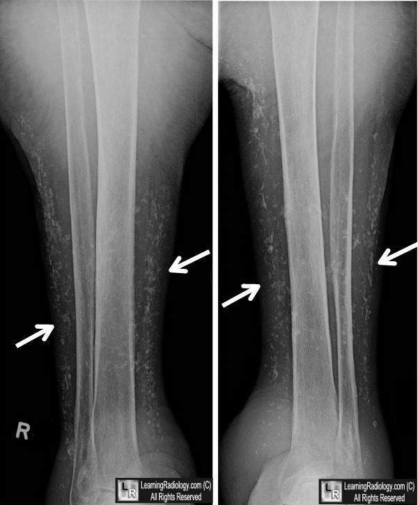 Learningradiology