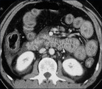 Shock Bowel-2