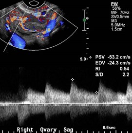 color and Doppler