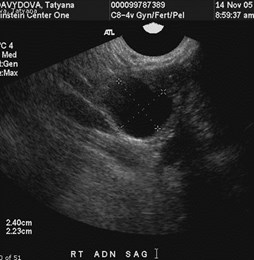 cyst 11-05