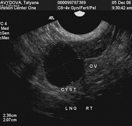 cyst 12-06