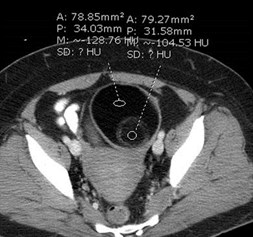 CT 3