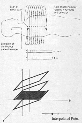 Spiral CT