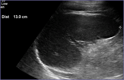 spleen 9-24 13cm.jpg
