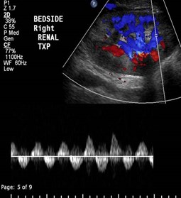 first study puls veins