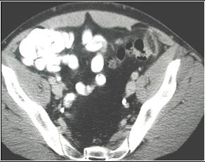 LearningRadiology Abdominal Pain