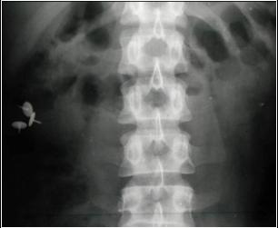 Learningradiology Abdominal Pain