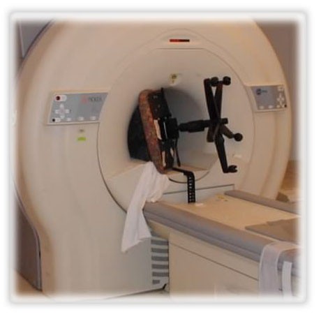 mri accidents