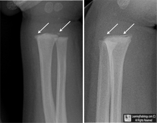 LearningRadiology