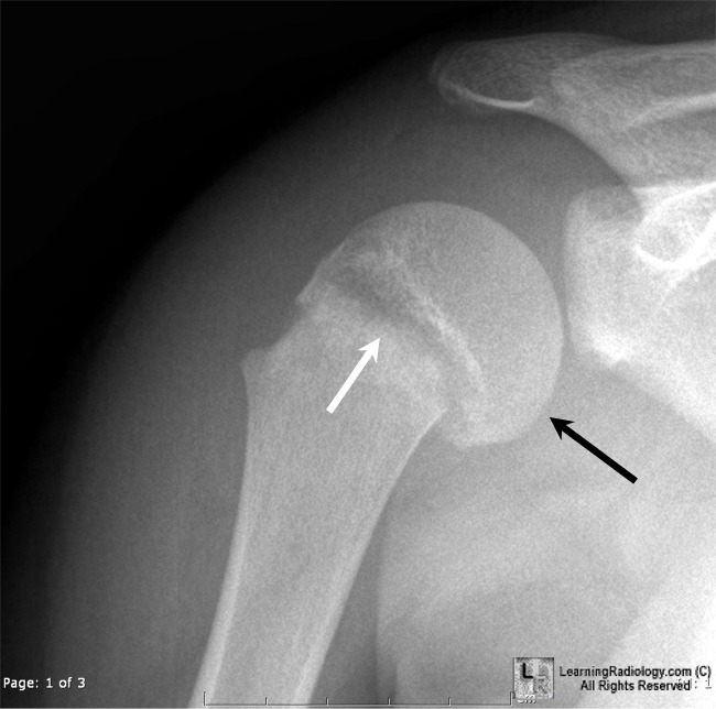 LearningRadiology