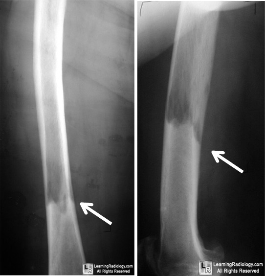 LearningRadiology