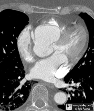 Welcome to LearningRadiology