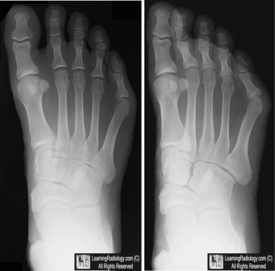 Welcome to LearningRadiology