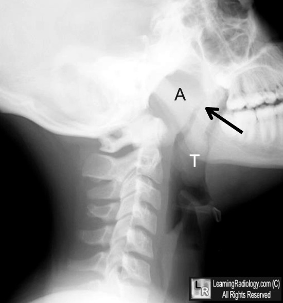 LearningRadiology