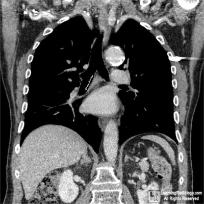 Welcome to LearningRadiology