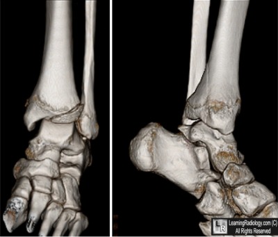 Welcome to LearningRadiology