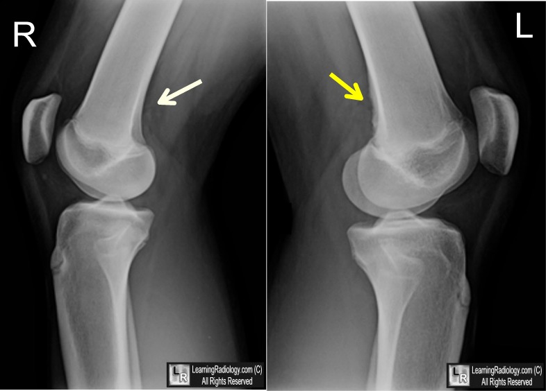 LearningRadiology