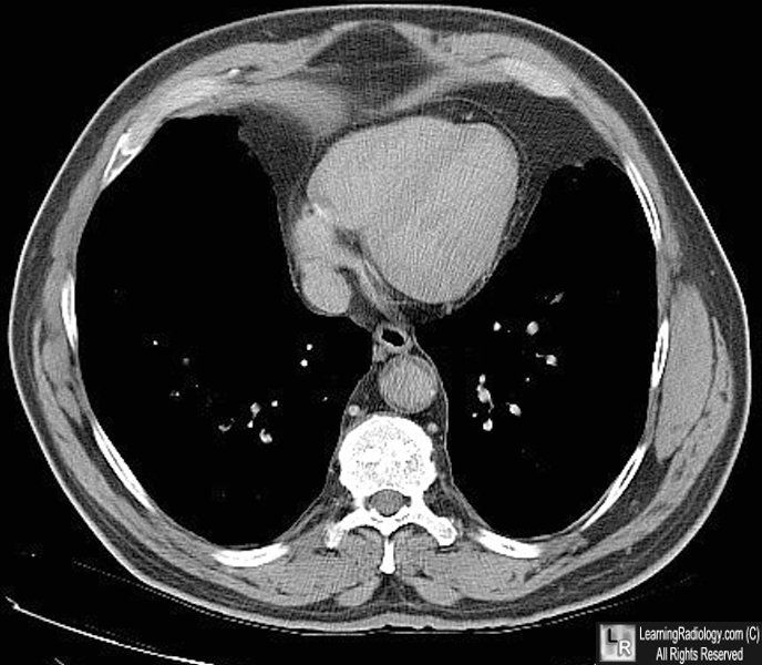 Learning Radiology - Archives 2016