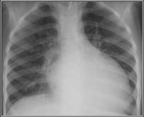 Cardiac Radiology Boards Review