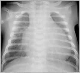 Cardiac Radiology Boards Review