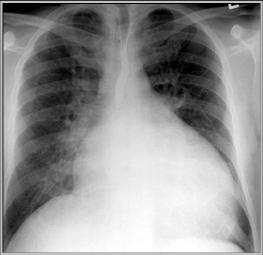 Cardiac Radiology Boards Review