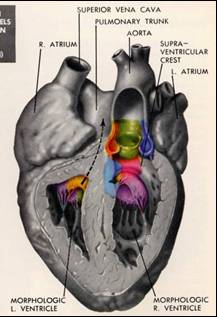 LearningRadiology- Cyanotic Heart Disease