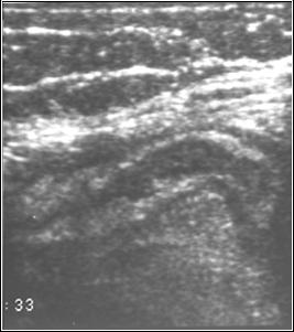 LearningRadiology.com-Abdominal Pain