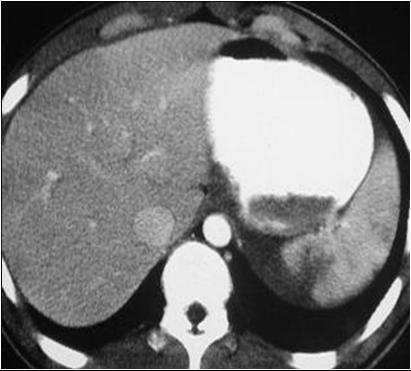 LearningRadiology.com-Acute Abdominal Emergencies