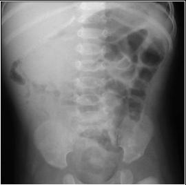 LearningRadiology.com-Acute Abdominal Emergencies