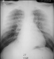 LearningRadiology-Recognizing a Technically Adequate Chest X-Ray